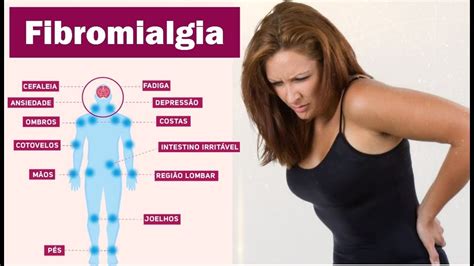 fibromialgia sintomas iniciais-4